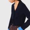 Cardigan with removable details Cardigan with removable details